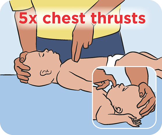 choking first aid for children