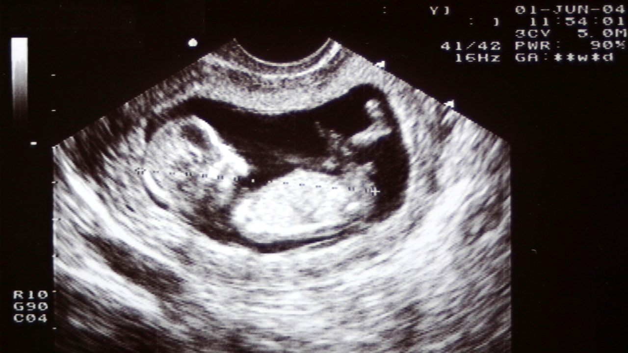 What should you see on a 6 week ultrasound