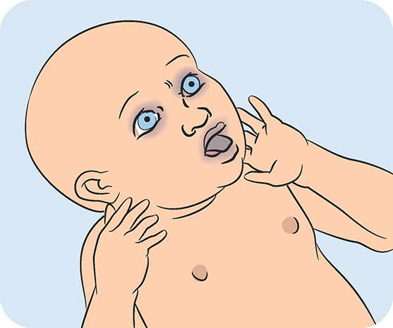 newborn chokes breastfeeding