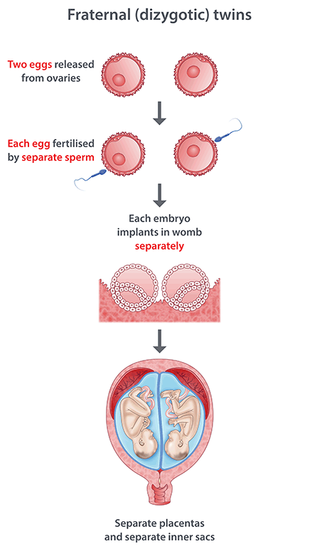 fraternal twins illustration