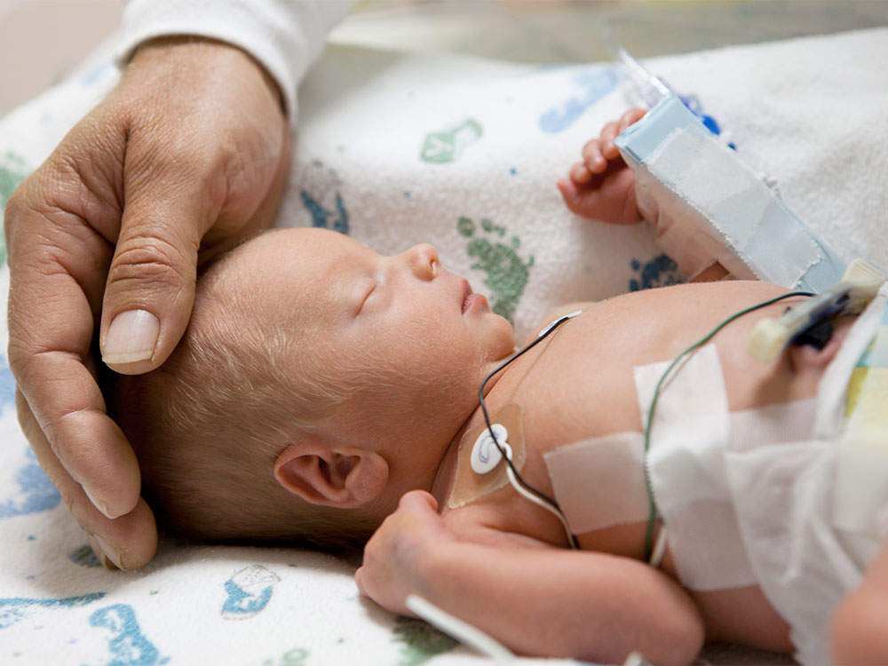 Premature birth & premature babies | Raising Children Network