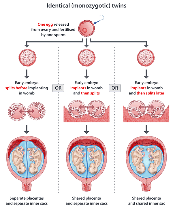 identical twins illustration