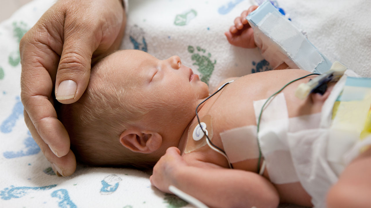 Preterm Birth Premature Labour Premature Babies