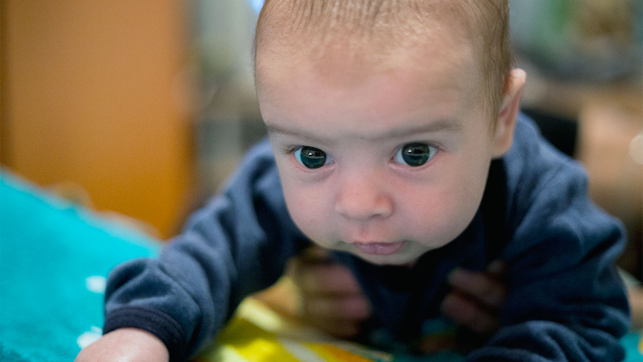 Plagiocephaly or flat head in babies | Raising Network