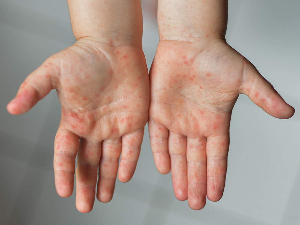 baby walking on hands and feet