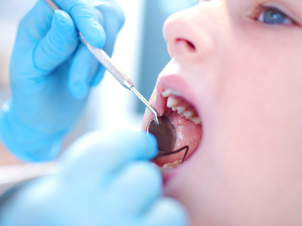 Tooth decay: babies, children & teenagers
